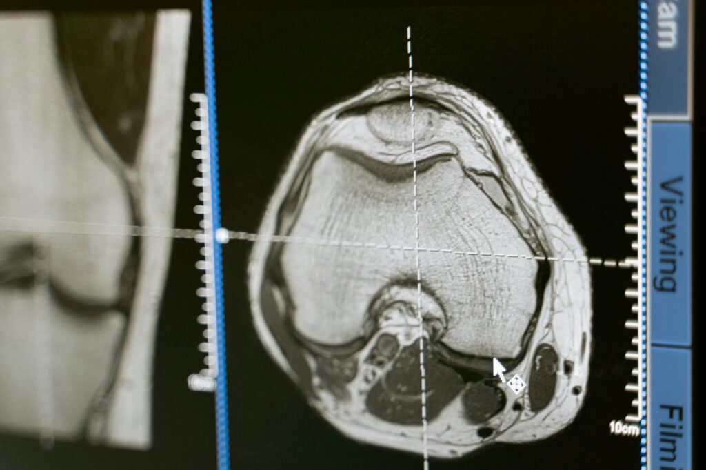 AI‑Powered Imaging Redefines Diagnostic Capital and Institutional Power
