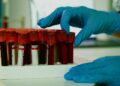 Decentralized Trials Redefine Pharma’s Cost Structure and Regulatory Playbook