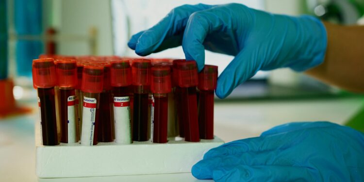 Decentralized Trials Redefine Pharma’s Cost Structure and Regulatory Playbook