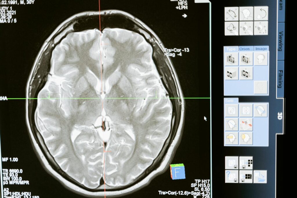 Neuroplasticity, Self‑Awareness, and the New Architecture of Career Capital