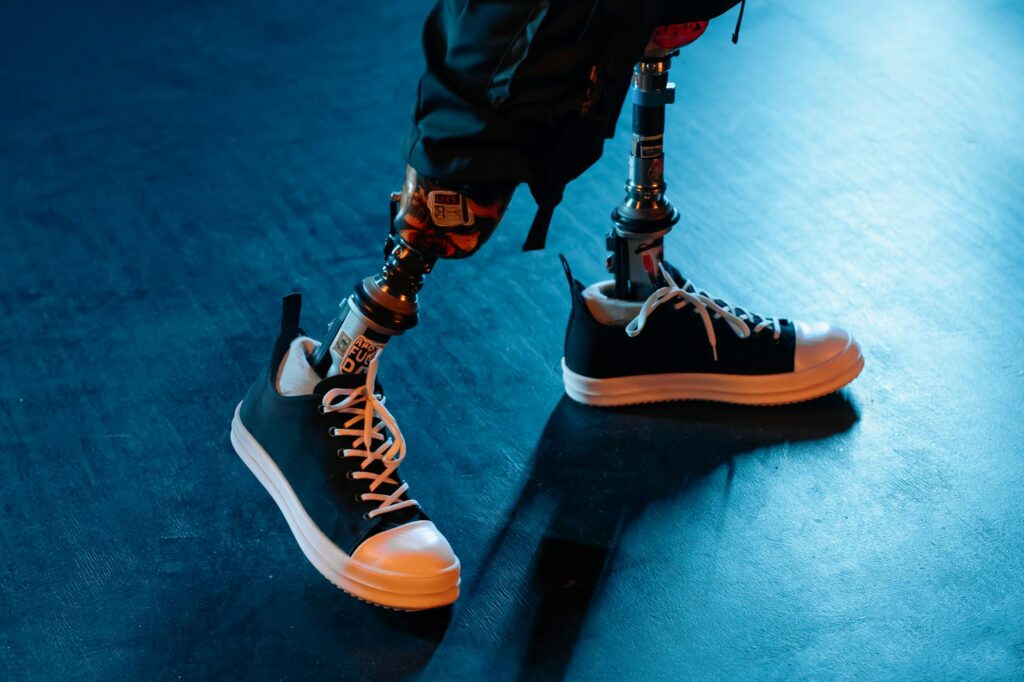 Adaptive Edge: How Sports Technology Is Re‑shaping Institutional Power and Career Capital for Athletes with Disabilities