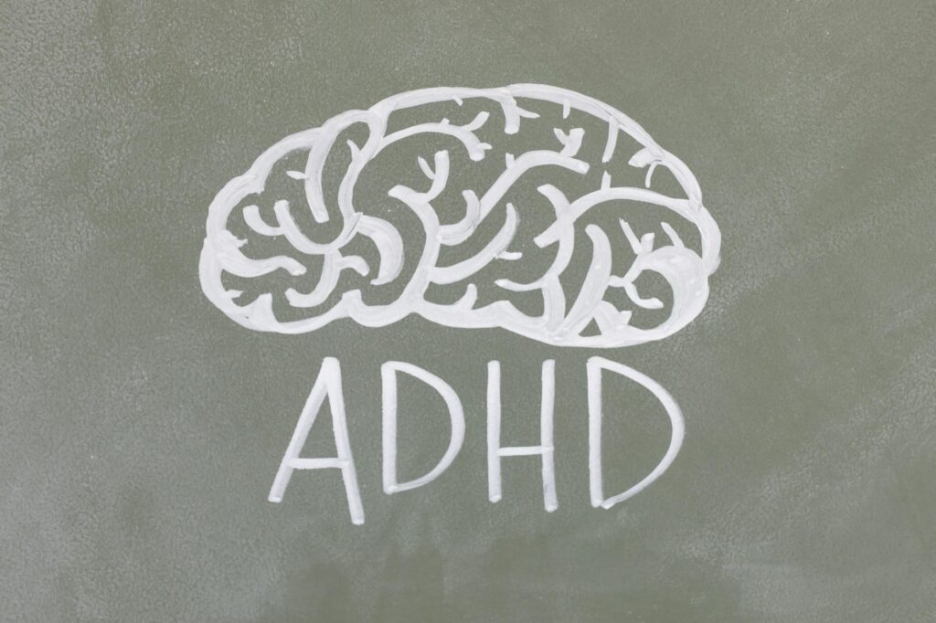 Compassionate Cognition: How Self‑Compassion Reshapes High‑Stakes Performance