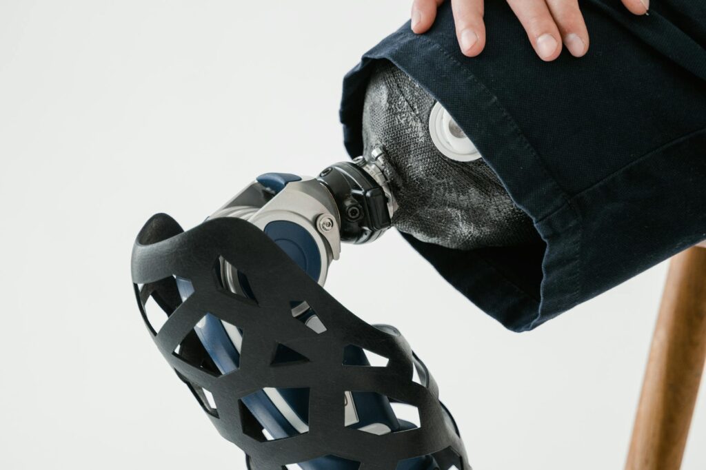 Wearables Redefine Occupational Rehab: From Reactive Bandages to Predictive Biomechanics