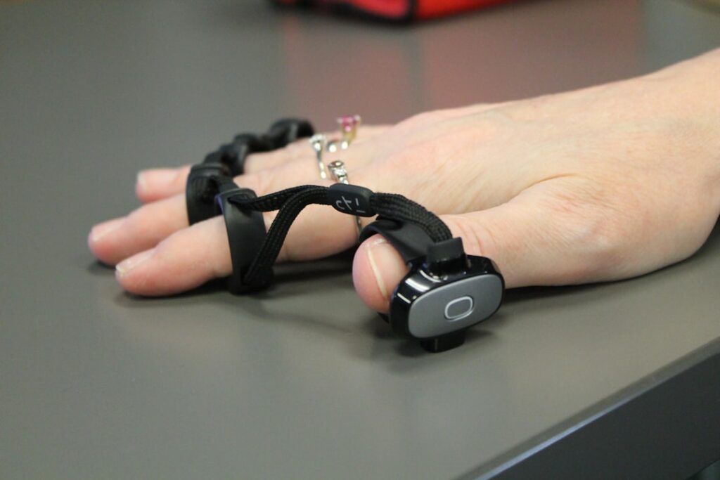 Wearables Redefine Occupational Rehab: From Reactive Bandages to Predictive Biomechanics