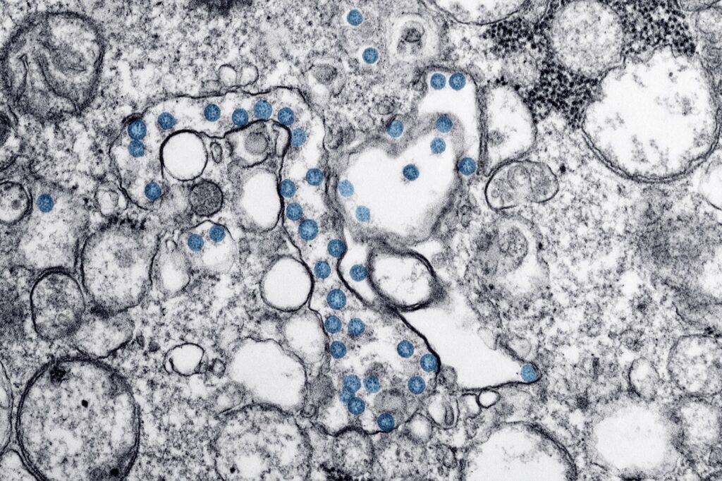 Microbiome Diversity Shapes Workplace Mental Health and Output
