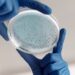 Glasgow Biotech Firm Mironid Secures €39.9 Million Series B to Advance ADPKD Therapy